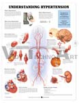 Understanding Hypertension Anatomical Chart